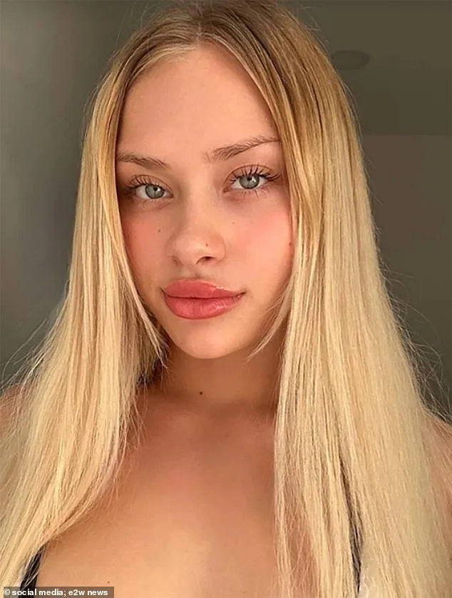 Maria Kovalchuk Survives Severe Injuries from Dubai Fall, Begins Recovery in Norway