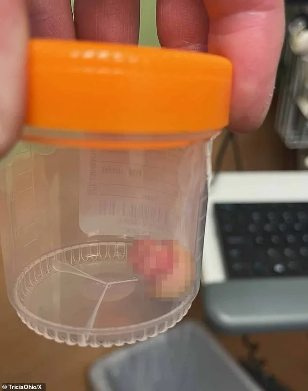 Minneapolis Protests and Federal Use of Force Spark Outrage and Safety Concerns