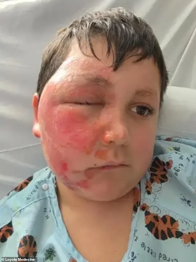 Nine-Year-Old Critical After Microwaving Needoh Cube in TikTok Trend Linked to Nationwide Injuries