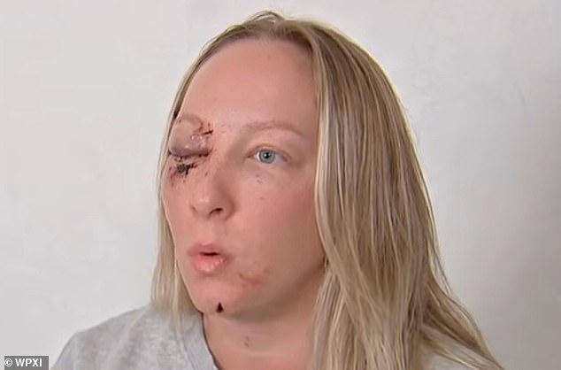 Massive Ice Slab Shatters Windshield, Injuring Pennsylvania Mother Near Pittsburgh