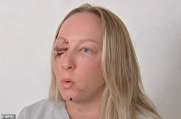 Massive Ice Slab Shatters Windshield, Injuring Pennsylvania Mother Near Pittsburgh