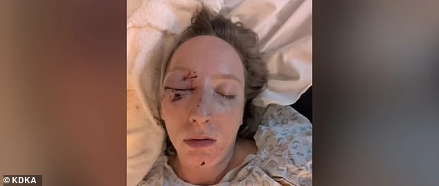 Massive Ice Slab Shatters Windshield, Injuring Pennsylvania Mother Near Pittsburgh