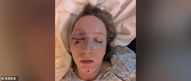 Massive Ice Slab Shatters Windshield, Injuring Pennsylvania Mother Near Pittsburgh