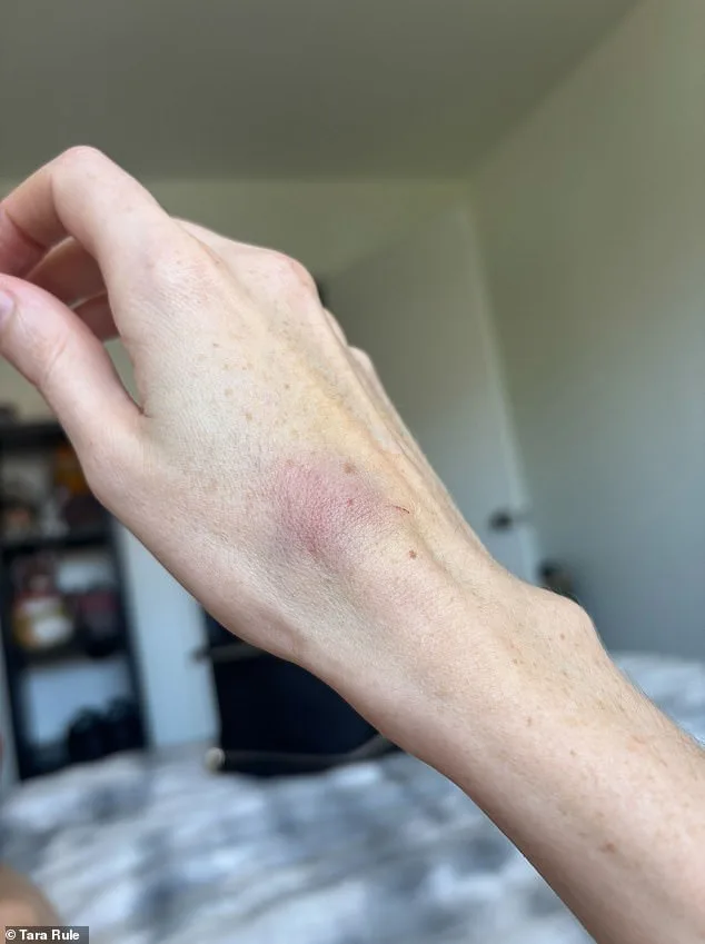 Breaking: TikTok Influencer with EDS Alleges Refusal of Assistance by American Airlines During Flight