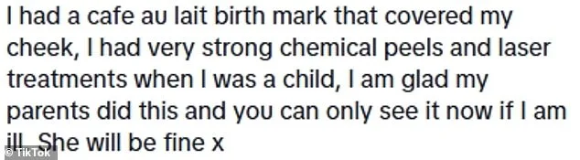 Mother Lasers Daughter's Congenital Nevus Birthmark at One Year Old to Prevent Bullying, Sparks Debate